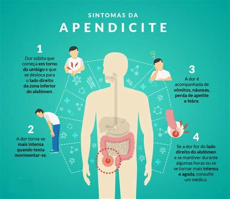 sintomas da apendicite